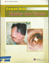 Image of Cegah dini kanker dan tumor